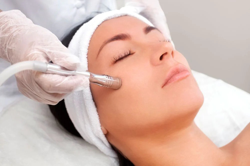 Add On - Microdermabrasion